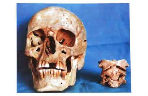 ARQUE.-107-Bronce-Cerro-de-los-Cuchillos-Almansa